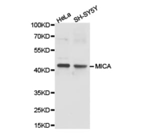 Anti-MICA Antibody from Bioworld Technology (BS6664) - Antibodies.com