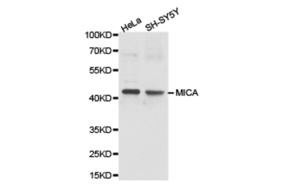 Anti-MICA Antibody from Bioworld Technology (BS6664) - Antibodies.com