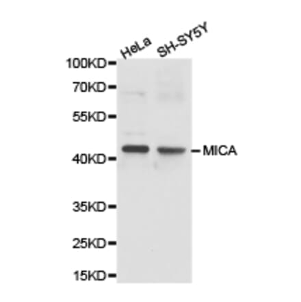 Anti-MICA Antibody from Bioworld Technology (BS6664) - Antibodies.com