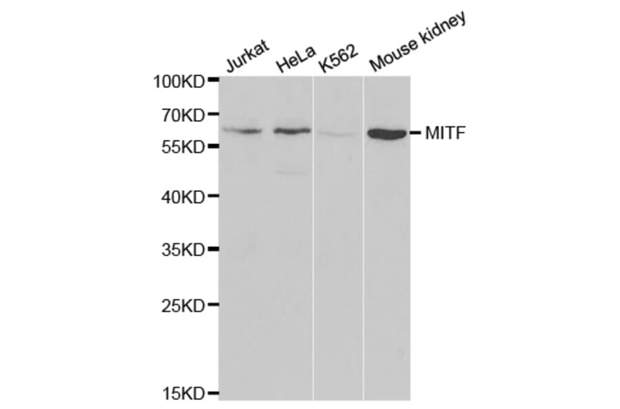 Anti-MITF Antibody from Bioworld Technology (BS6666) - Antibodies.com