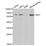 Anti-MITF Antibody from Bioworld Technology (BS6666) - Antibodies.com