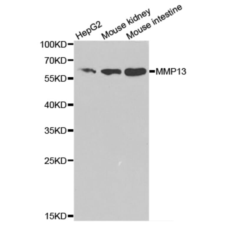 Anti-MMP-13 Antibody from Bioworld Technology (BS6668) - Antibodies.com