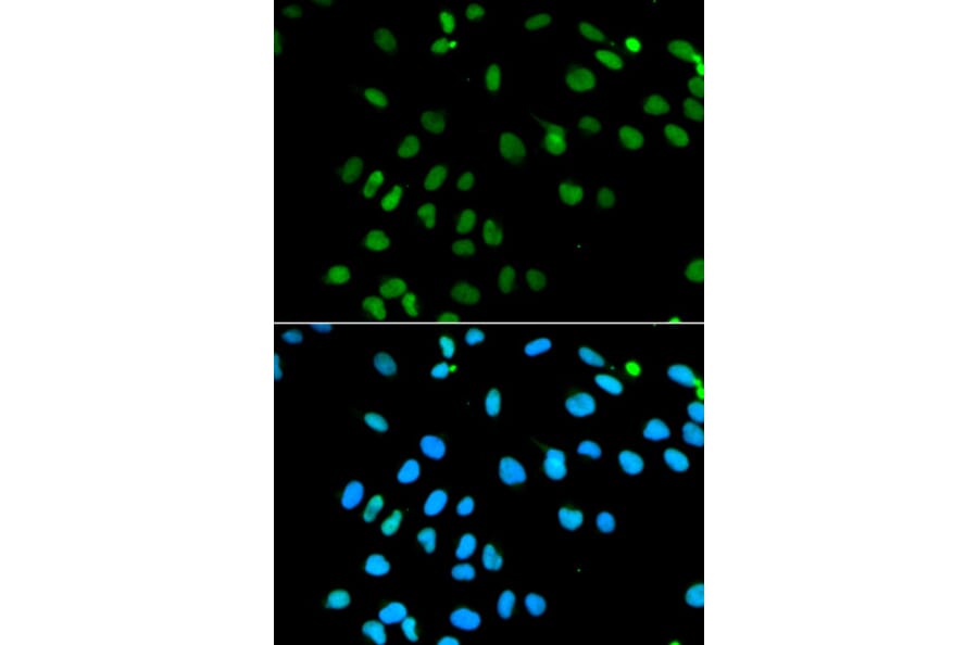 Anti-MNAT1 Antibody from Bioworld Technology (BS6669) - Antibodies.com