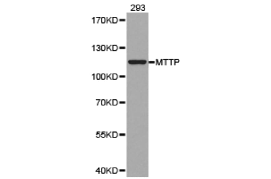 Anti-MTTP Antibody from Bioworld Technology (BS6672) - Antibodies.com
