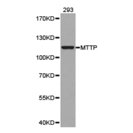 Anti-MTTP Antibody from Bioworld Technology (BS6672) - Antibodies.com