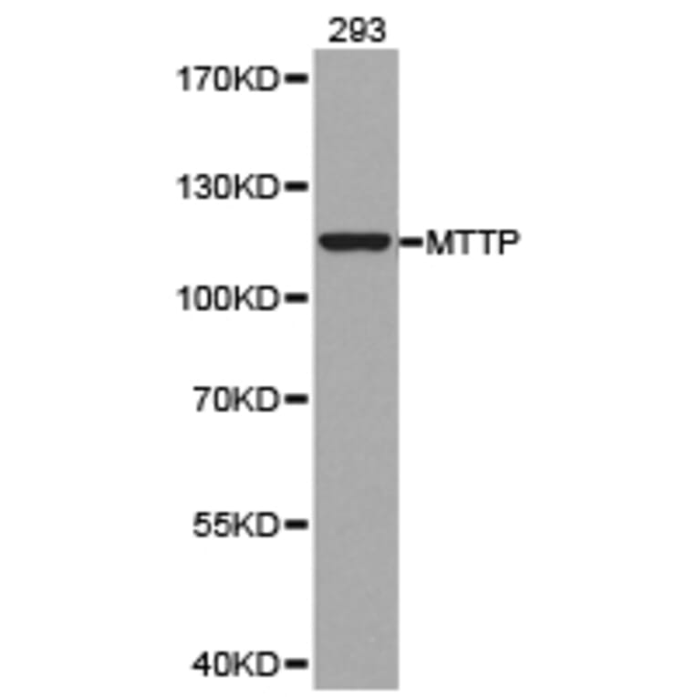 Anti-MTTP Antibody from Bioworld Technology (BS6672) - Antibodies.com