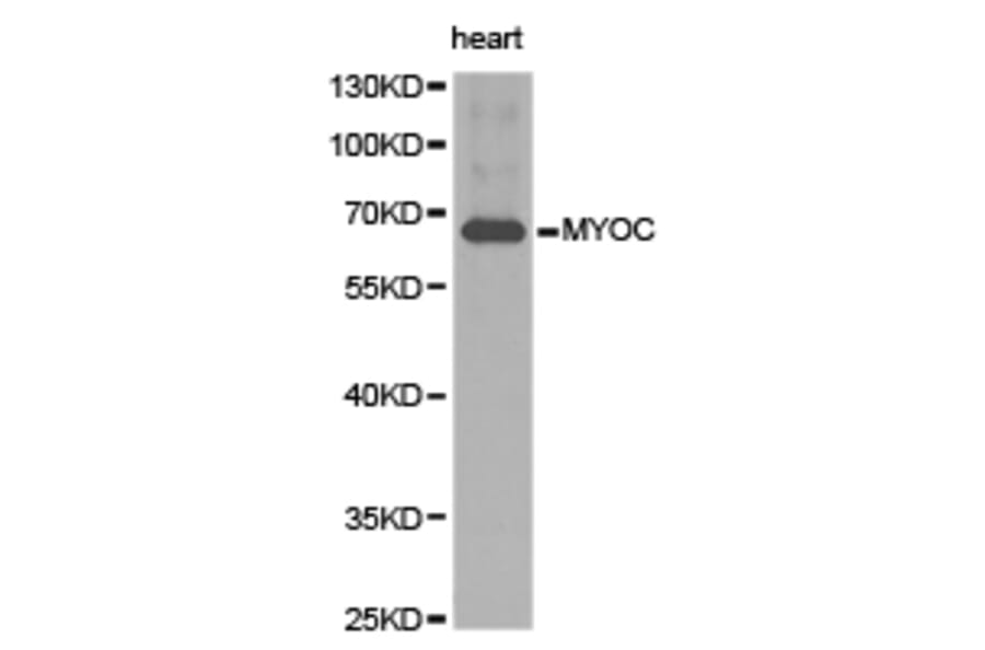 Anti-MYOC Antibody from Bioworld Technology (BS6675) - Antibodies.com