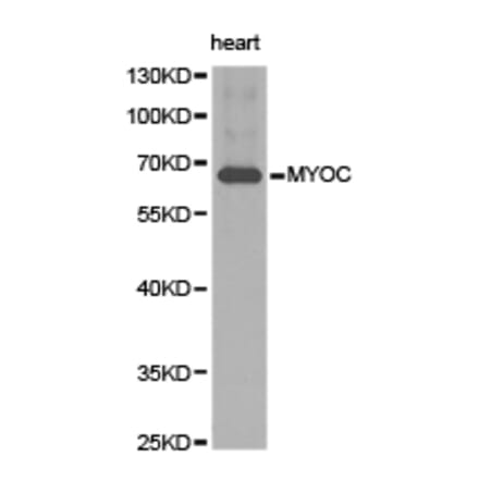 Anti-MYOC Antibody from Bioworld Technology (BS6675) - Antibodies.com