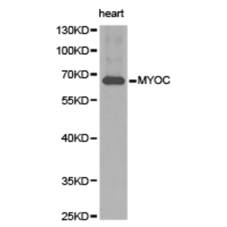 Anti-MYOC Antibody from Bioworld Technology (BS6675) - Antibodies.com