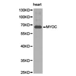 Anti-MYOC Antibody from Bioworld Technology (BS6675) - Antibodies.com