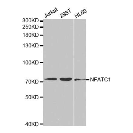 Anti-NFATC1 Antibody from Bioworld Technology (BS6677) - Antibodies.com