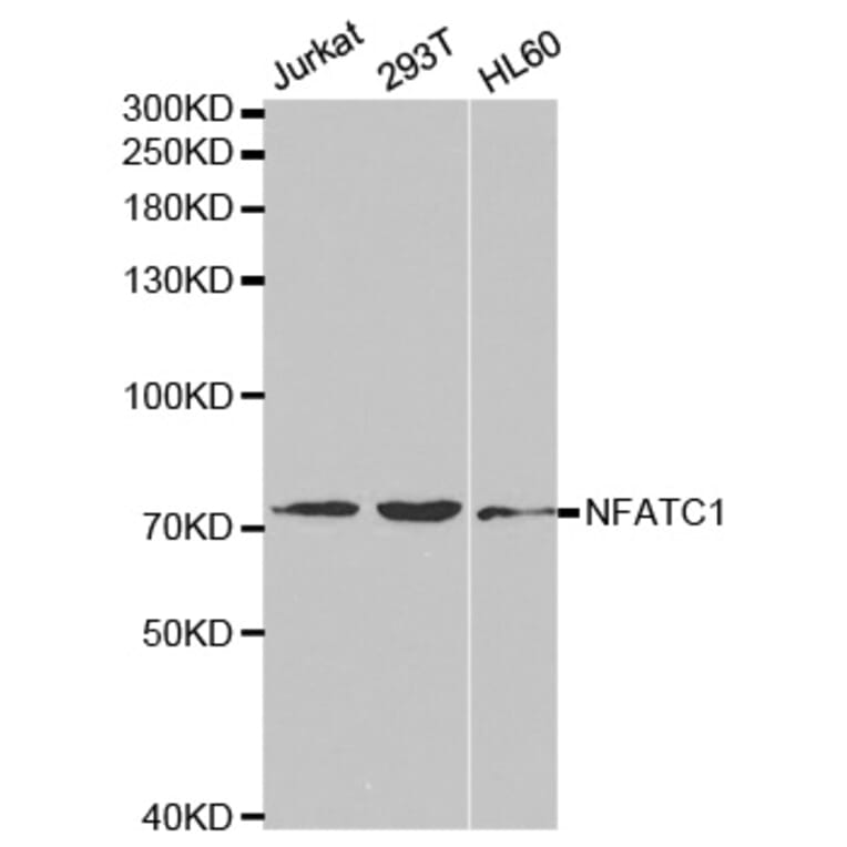 Anti-NFATC1 Antibody from Bioworld Technology (BS6677) - Antibodies.com