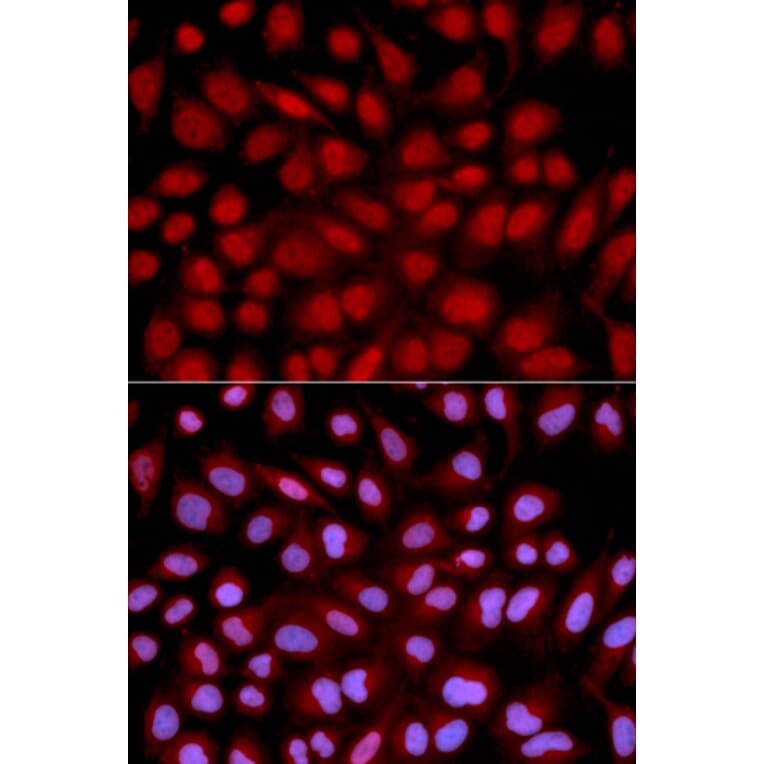 Anti-NFATC1 Antibody from Bioworld Technology (BS6677) - Antibodies.com