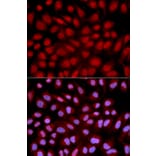 Anti-NFATC1 Antibody from Bioworld Technology (BS6677) - Antibodies.com