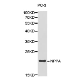 Anti-NPPA Antibody from Bioworld Technology (BS6680) - Antibodies.com