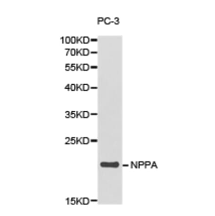 Anti-NPPA Antibody from Bioworld Technology (BS6680) - Antibodies.com
