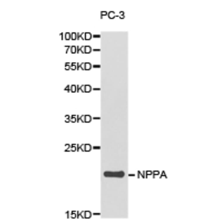 Anti-NPPA Antibody from Bioworld Technology (BS6680) - Antibodies.com