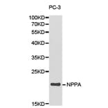 Anti-NPPA Antibody from Bioworld Technology (BS6680) - Antibodies.com