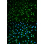 Anti-NT5E Antibody from Bioworld Technology (BS6682) - Antibodies.com