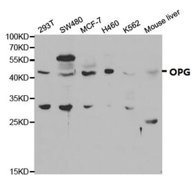 Anti-OPG Antibody from Bioworld Technology (BS6684) - Antibodies.com