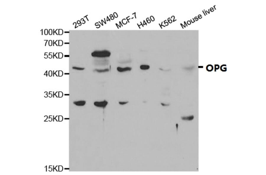 Anti-OPG Antibody from Bioworld Technology (BS6684) - Antibodies.com