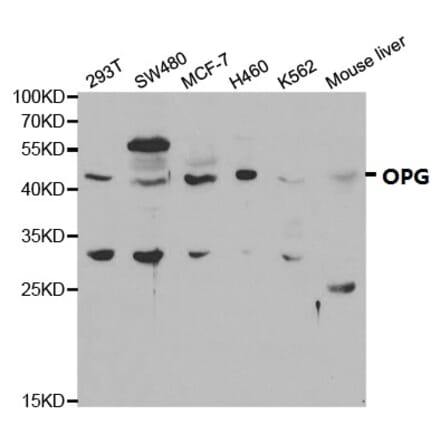 Anti-OPG Antibody from Bioworld Technology (BS6684) - Antibodies.com