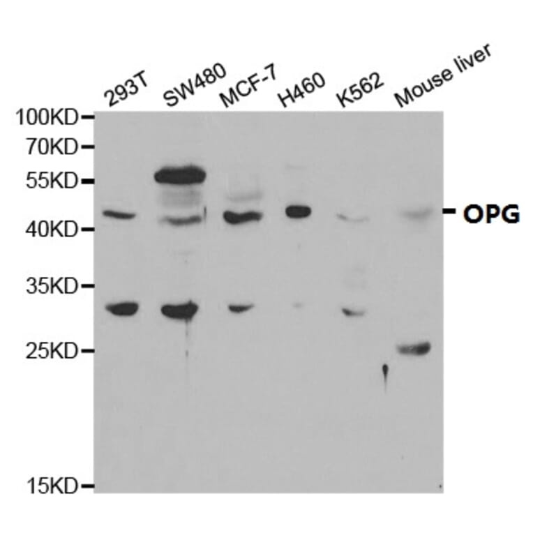 Anti-OPG Antibody from Bioworld Technology (BS6684) - Antibodies.com