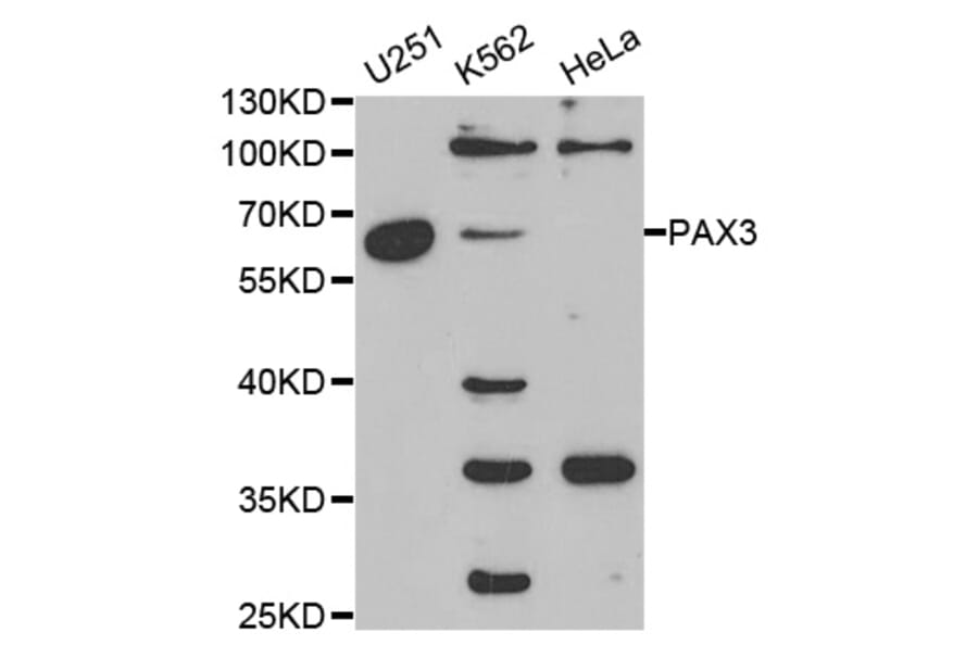Anti-Pax-3 Antibody from Bioworld Technology (BS6686) - Antibodies.com
