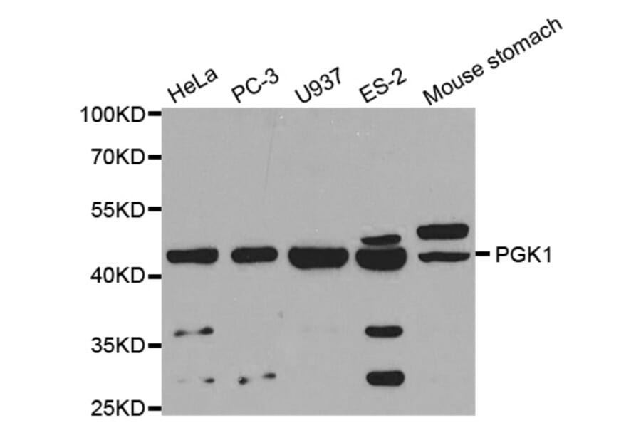 Anti-PGK1 Antibody from Bioworld Technology (BS6691) - Antibodies.com