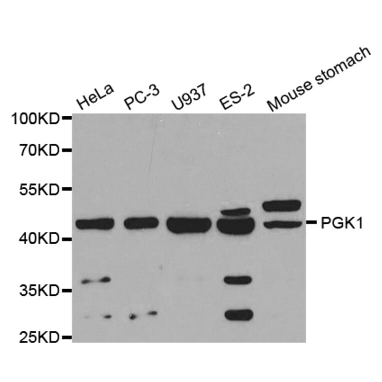 Anti-PGK1 Antibody from Bioworld Technology (BS6691) - Antibodies.com