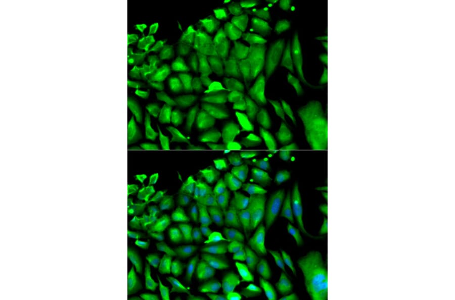 Anti-PGK1 Antibody from Bioworld Technology (BS6691) - Antibodies.com