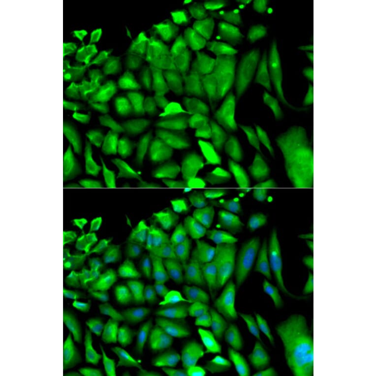 Anti-PGK1 Antibody from Bioworld Technology (BS6691) - Antibodies.com