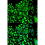 Anti-PGK1 Antibody from Bioworld Technology (BS6691) - Antibodies.com
