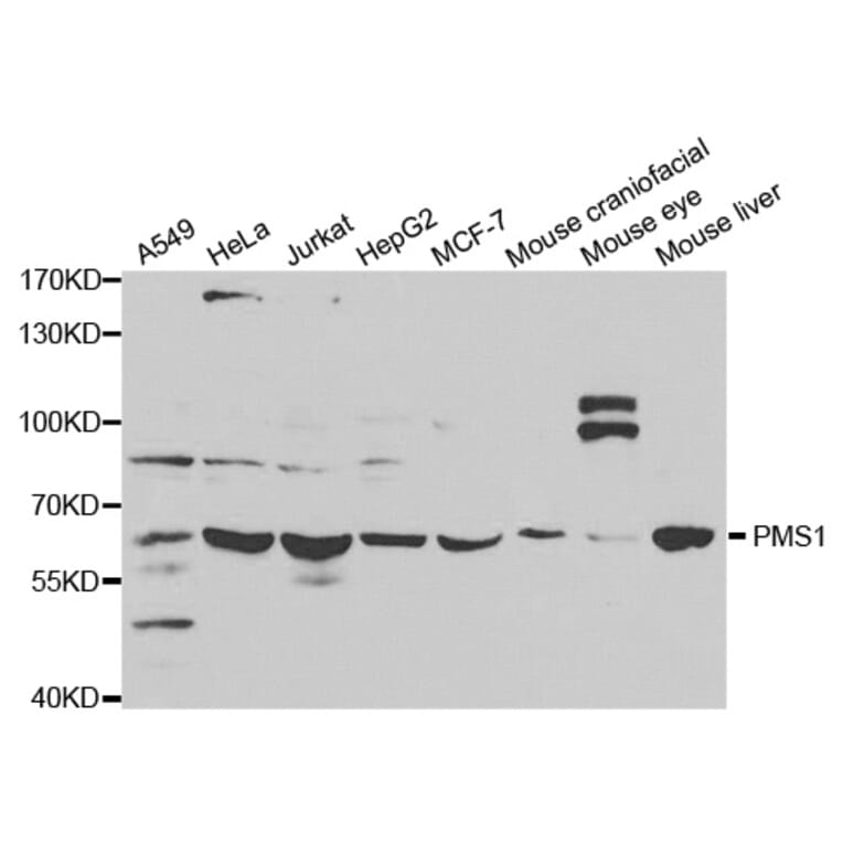 Anti-PMS1 Antibody from Bioworld Technology (BS6694) - Antibodies.com