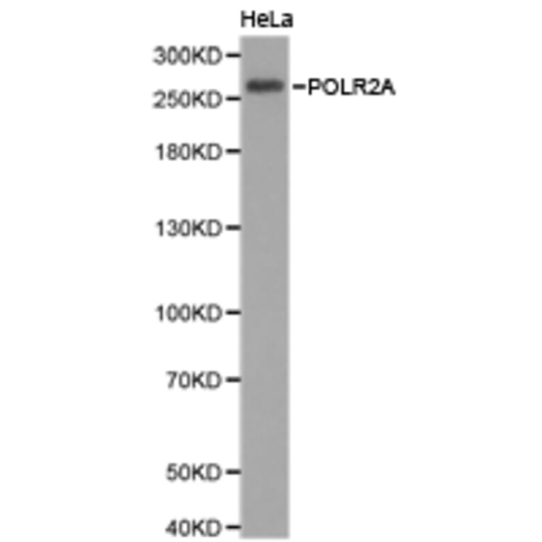 Anti-Rpb1/POLR2A Antibody from Bioworld Technology (BS6696) - Antibodies.com