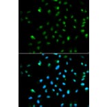 Anti-Rpb1/POLR2A Antibody from Bioworld Technology (BS6696) - Antibodies.com