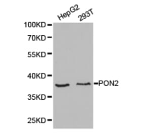 Anti-PON2 Antibody from Bioworld Technology (BS6697) - Antibodies.com