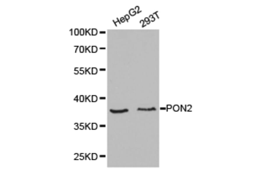 Anti-PON2 Antibody from Bioworld Technology (BS6697) - Antibodies.com