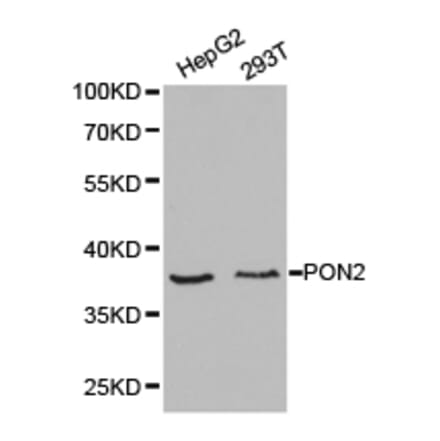 Anti-PON2 Antibody from Bioworld Technology (BS6697) - Antibodies.com