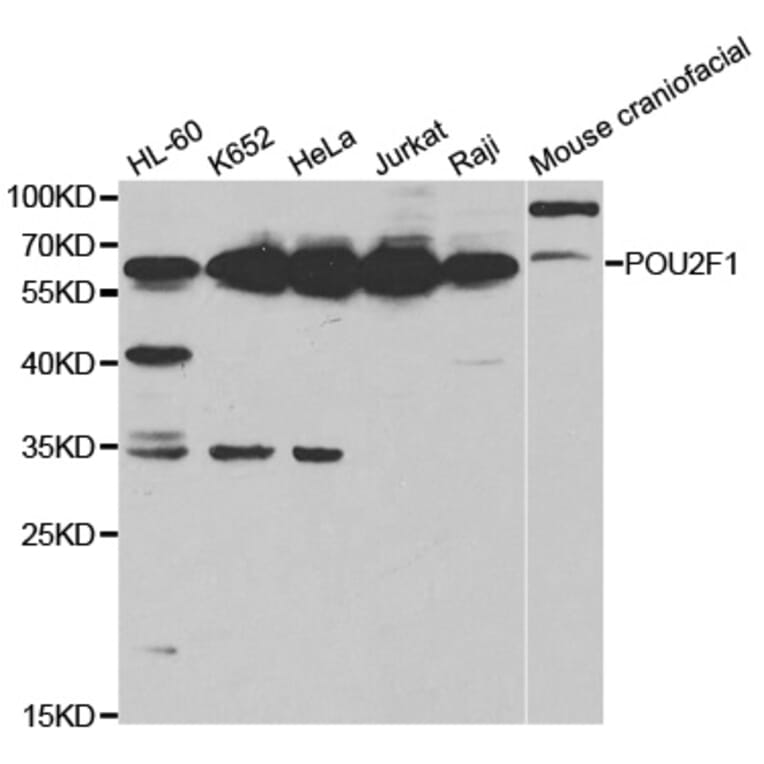 Anti-Oct-1/POU2F1 Antibody from Bioworld Technology (BS6698) - Antibodies.com