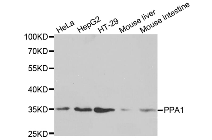 Anti-PPA1 Antibody from Bioworld Technology (BS6699) - Antibodies.com