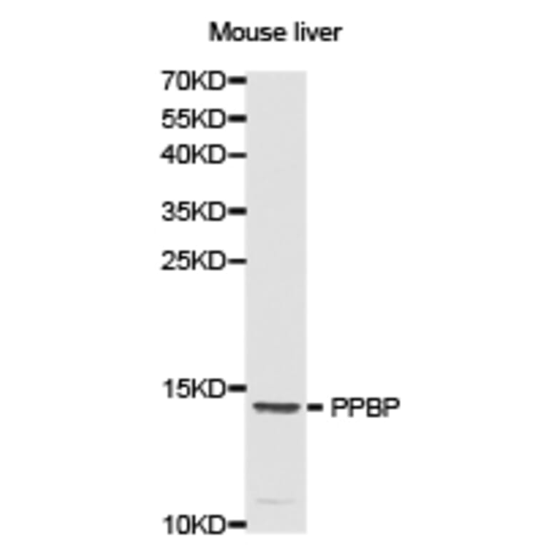 AntiPPBP Anticuerpo (A29954)