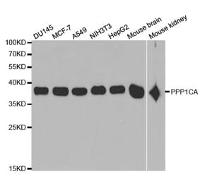Anti-PPP1CA Antibody from Bioworld Technology (BS6702) - Antibodies.com