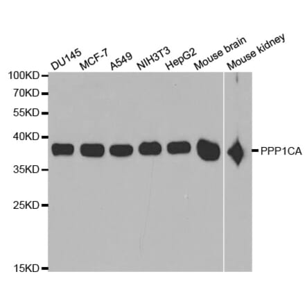 Anti-PPP1CA Antibody from Bioworld Technology (BS6702) - Antibodies.com
