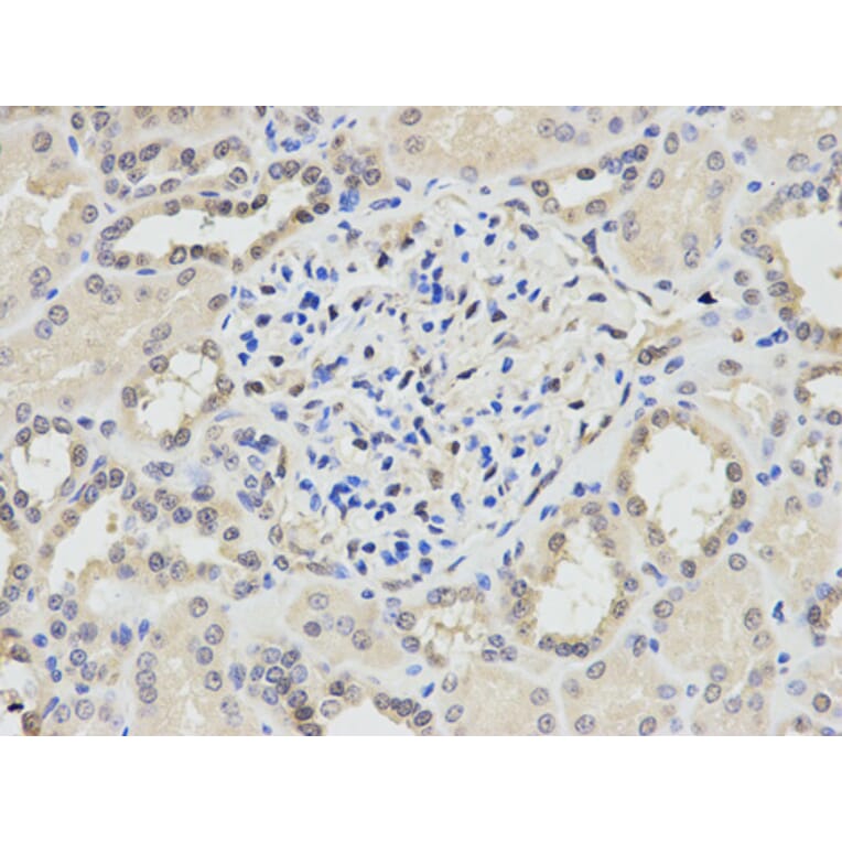 Anti-PPP1CA Antibody from Bioworld Technology (BS6702) - Antibodies.com