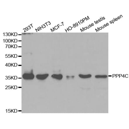 Anti-PPP4C Antibody from Bioworld Technology (BS6703) - Antibodies.com