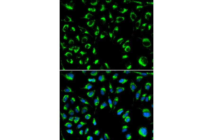 Anti-PPP4C Antibody from Bioworld Technology (BS6703) - Antibodies.com