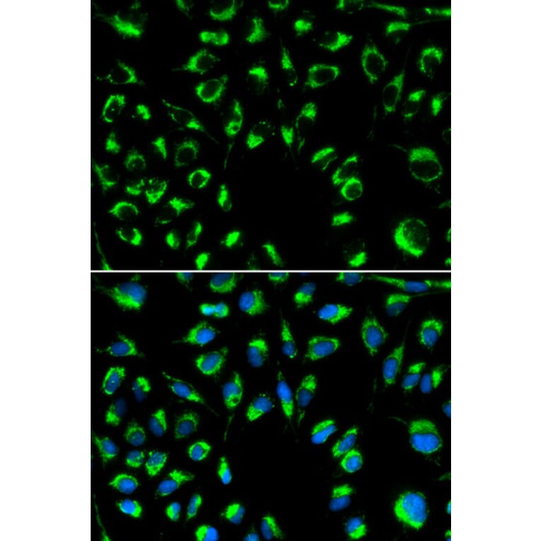 Anti-PPP4C Antibody from Bioworld Technology (BS6703) - Antibodies.com