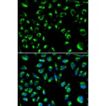 Anti-PPP4C Antibody from Bioworld Technology (BS6703) - Antibodies.com