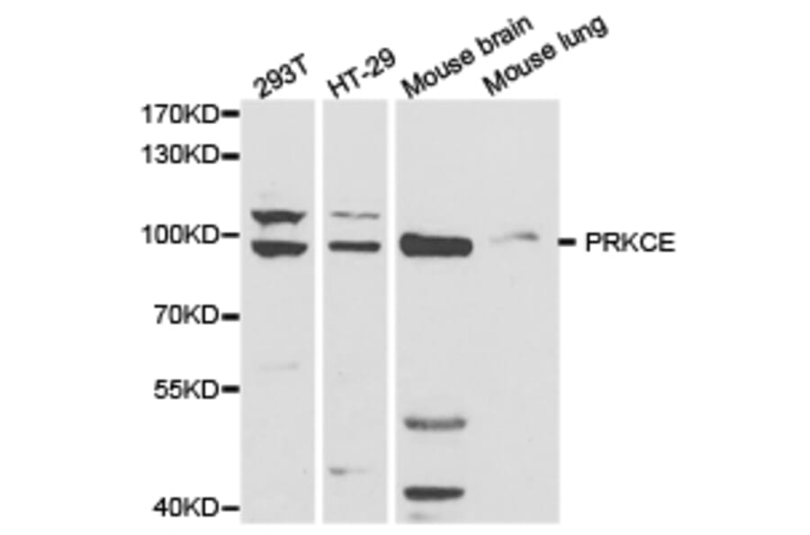 Anti-PKC ε/ PRKCE Antibody from Bioworld Technology (BS6704) - Antibodies.com